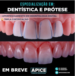 Especializa O Em Dent Stica E Pr Tese Dent Ria Pice Cursos