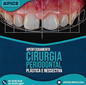 Aperfeiçoamento em Periodontia