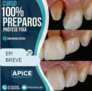 100% Preparos – Prótese Fixa